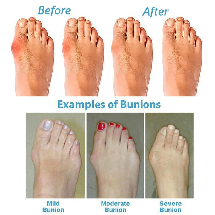 Women's Orthopedic Cushioned Sandals for Walking